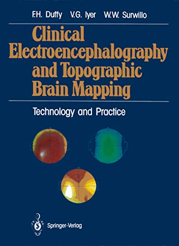 Clinical Electroencephalography and Topographic Brain Mapping: Technology and Practice