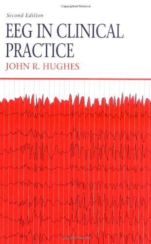 EEG in clinical prectice